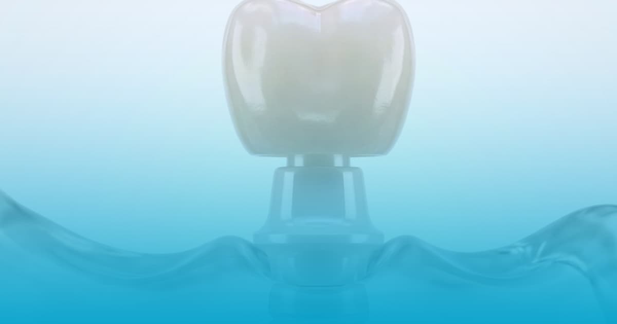 Implant dentar ceramic