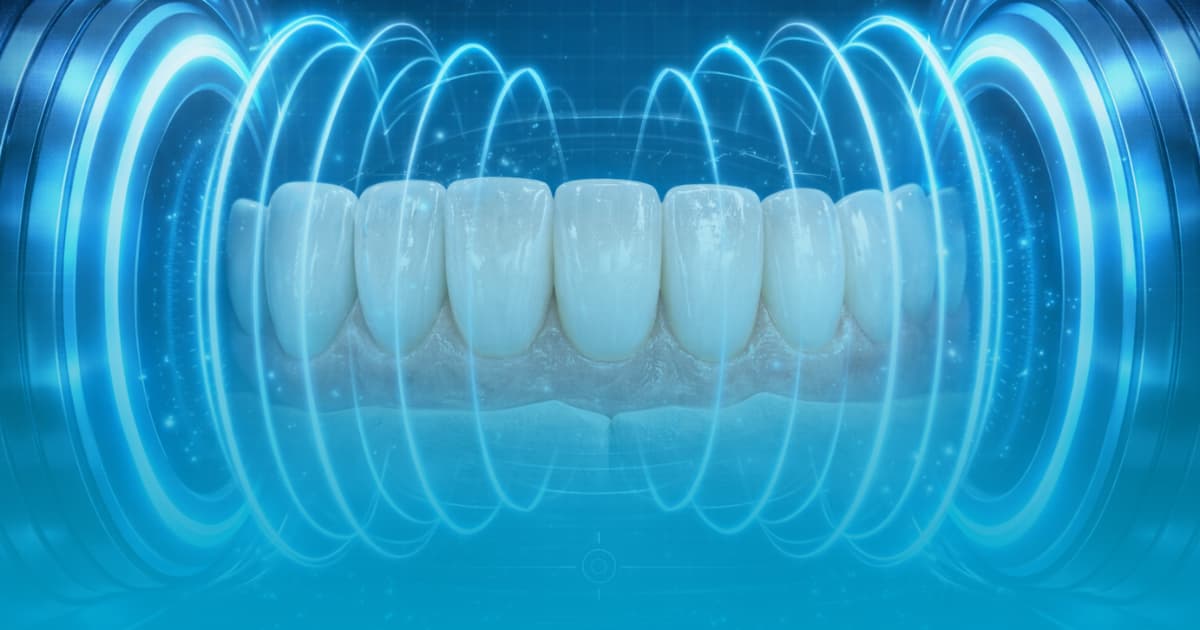 Fatete dentare si RMN: Sunt sigure investigatiile? Select Dental Clinic 8 fatete dentare si rmn